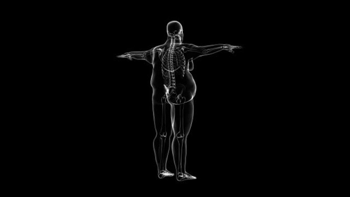 骨骼超重男子的x光 | 可循环