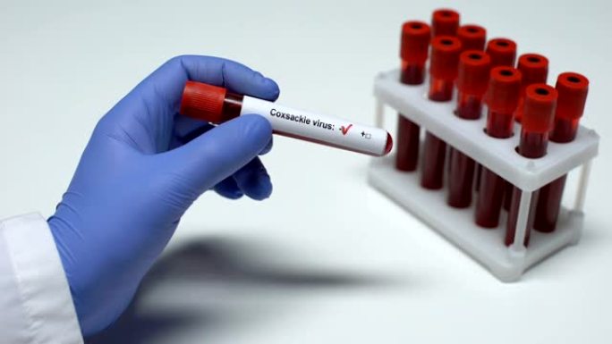 柯萨奇病毒测试阴性，医生显示血样，健康检查