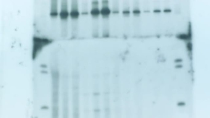 新型冠状病毒肺炎大流行病毒的DNA遗传分析结果