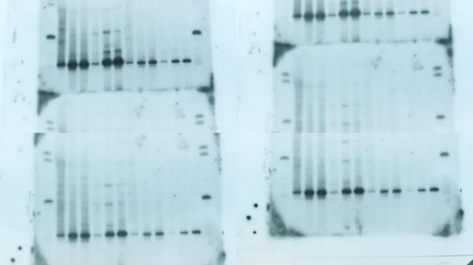 新型冠状病毒肺炎大流行病毒的DNA遗传分析结果