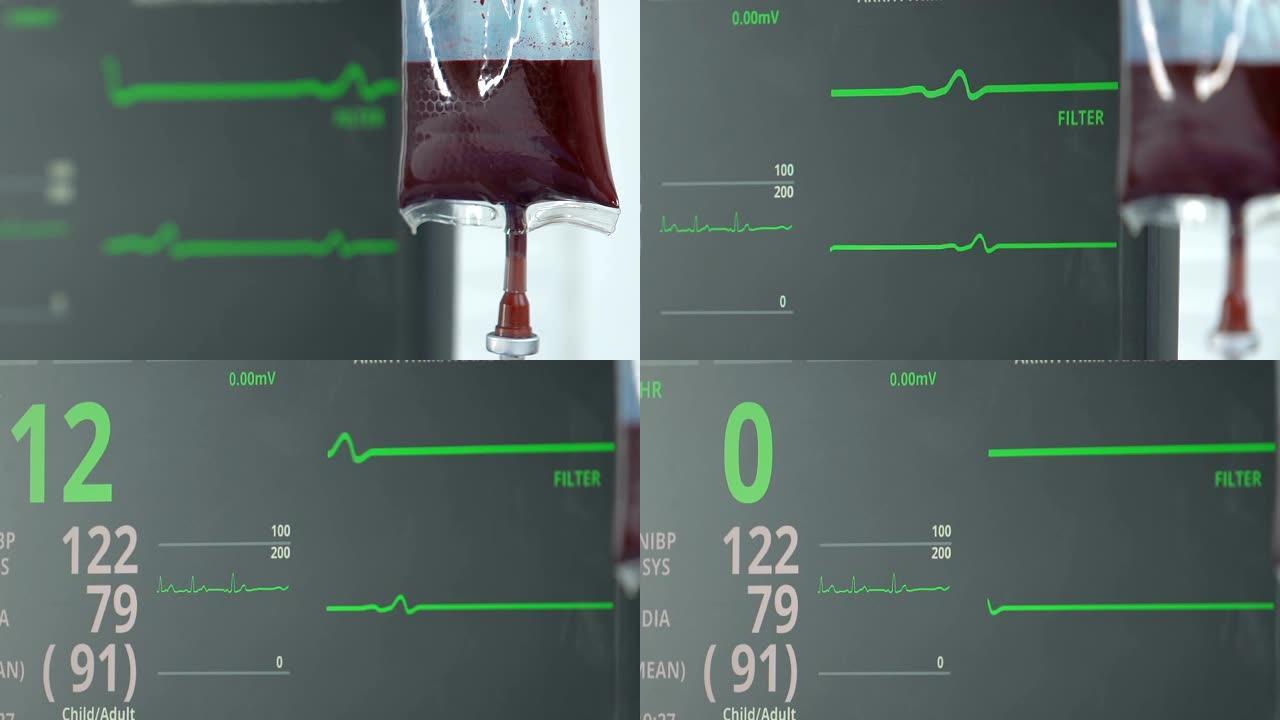 血滴和生命体征监测医院，心率消失显示