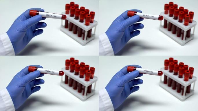 CD3 CD4检测，医生在试管中显示血样，实验室研究，健康检查