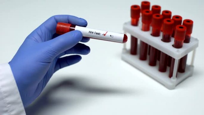 HIV检测阴性，医生显示血液样本，实验室研究，健康检查