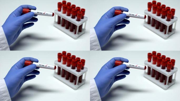 HIV检测阴性，医生显示血液样本，实验室研究，健康检查