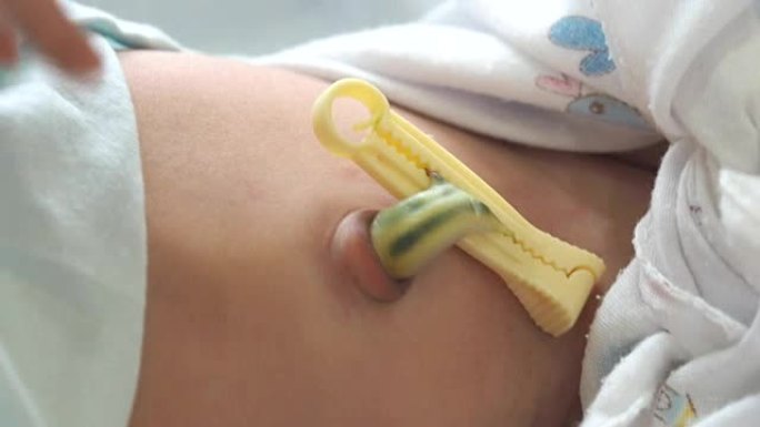 初生婴儿脐带初生婴儿脐带