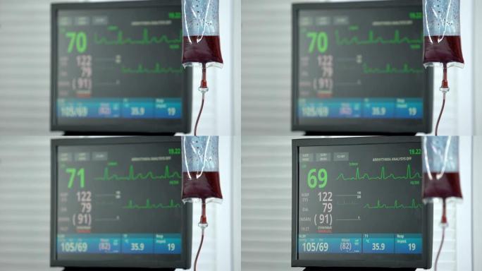 复活室心电图监护仪的稳定心率，输血