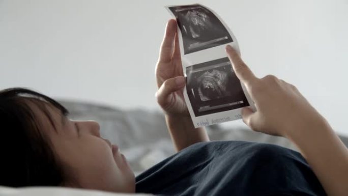 孕妇躺在床上，看着未来婴儿的3D超声照片