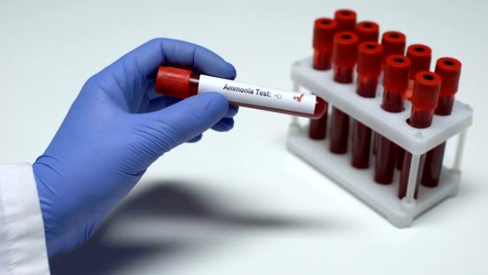 氨测试阳性，医生在试管中显示血样，实验室研究，健康