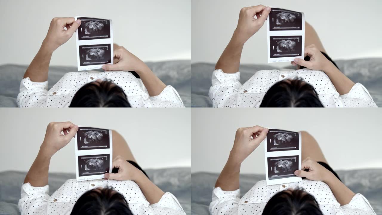 孕妇躺在床上，看着未来婴儿的3D超声照片