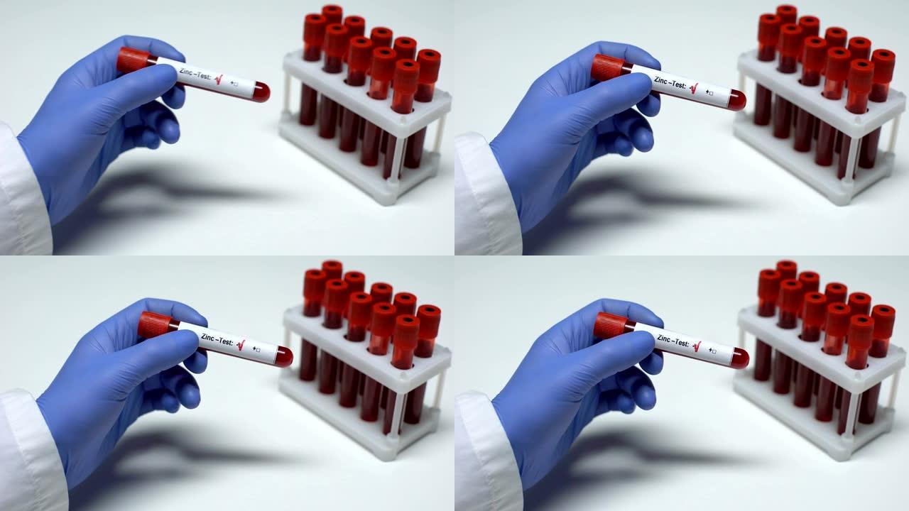 锌测试阴性，医生显示血样，实验室研究，健康检查