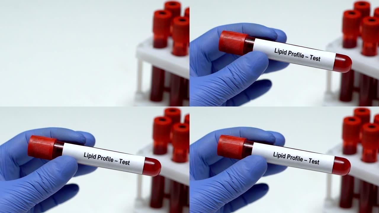 血脂检测，医生在试管中保存血液样本特写，健康检查