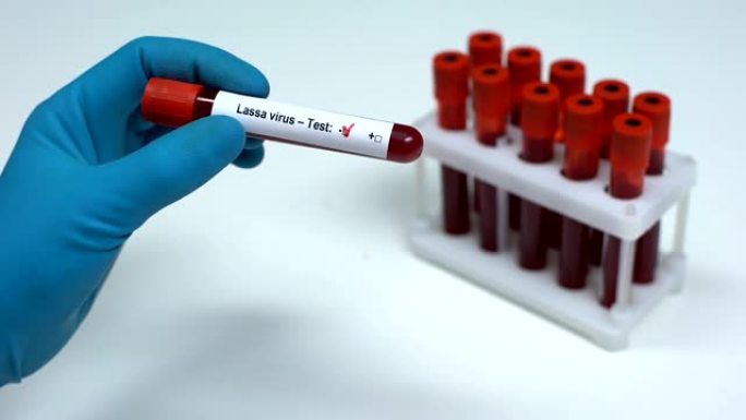 拉沙病毒检测阴性医生提供血样实验室研究保健