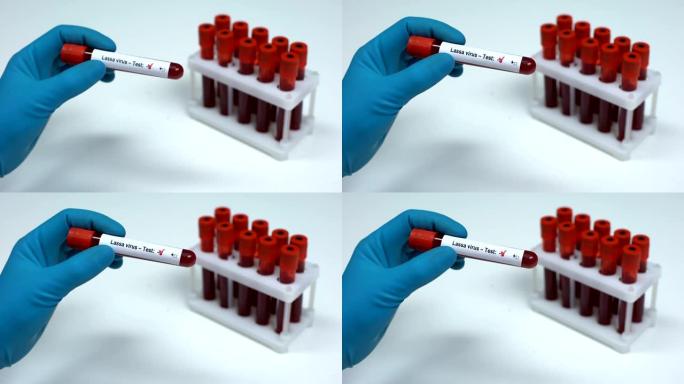 拉沙病毒检测阴性医生提供血样实验室研究保健