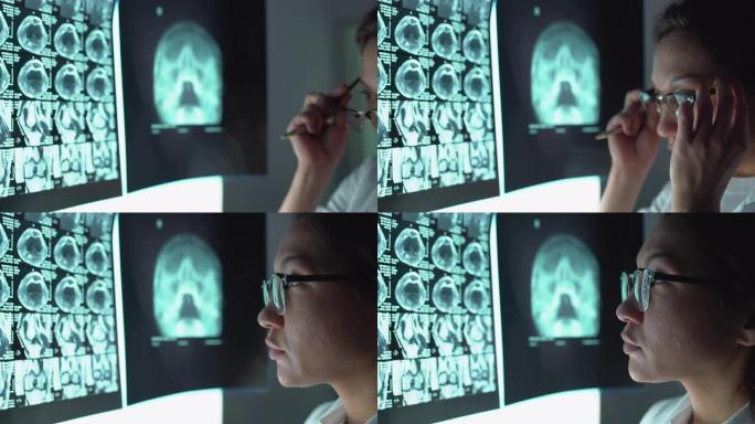 合格的外科医生戴着眼镜看核磁共振成像，治疗疾病，工作