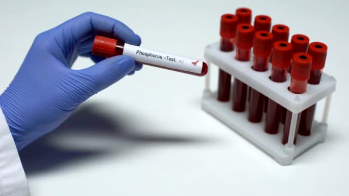 磷测试阳性，医生在试管中显示血样，实验室研究