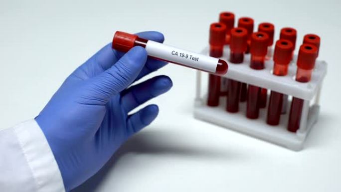 CA 19-9，医生在试管中显示血液样本，实验室研究，健康检查