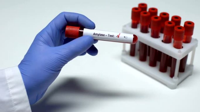 淀粉酶检测阴性，医生检查血样，实验室研究，健康检查