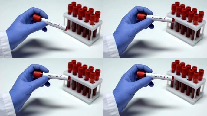淀粉酶检测阴性，医生检查血样，实验室研究，健康检查