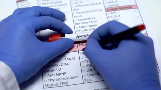 血脂谱，医生在实验室空白中检查疾病，显示血液样本
