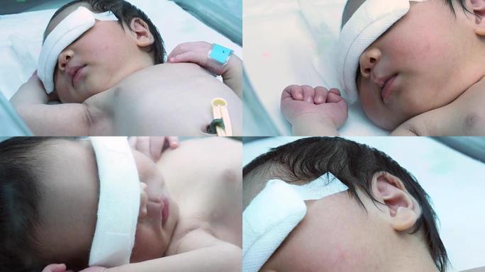 孵化器中的新生儿照紫外线的婴儿戴着眼镜