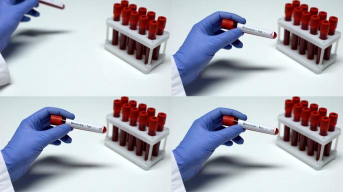 蛋白质印迹试验阳性，医生在试管中显示血样，实验室研究