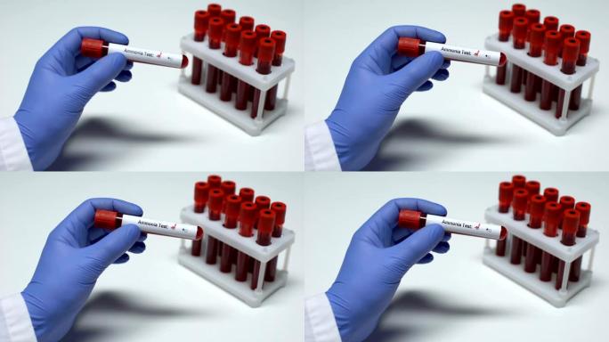 氨测试阴性，医生在试管中显示血样，实验室研究，健康