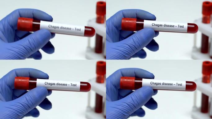 查加斯病-测试，医生在试管中保存血液样本特写，健康