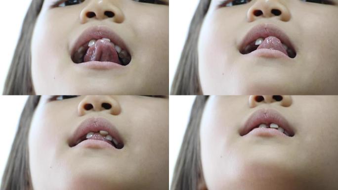 亚洲小女孩扭动一颗松动的牙齿