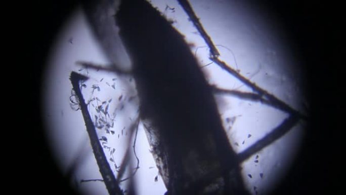 显微镜下的雌性蚊子