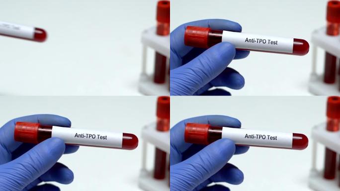 抗TPO检测，医生在试管中保存血液样本特写，健康检查