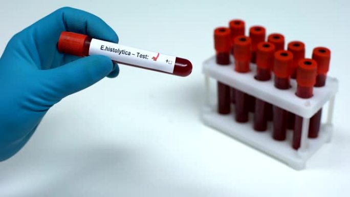 E溶组织试验阴性，医生显示血液样本实验室研究保健