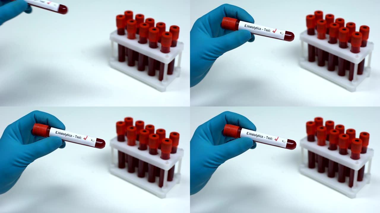 E溶组织试验阴性，医生显示血液样本实验室研究保健