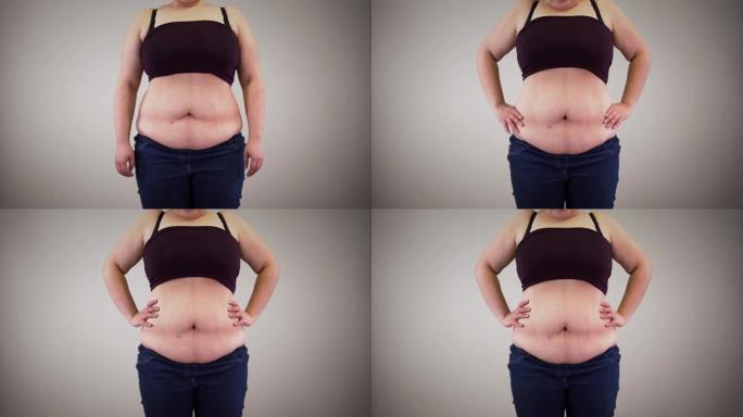 成年无法辨认的肥胖妇女缩回腹部放松。胖白人女人的身体。肥胖，超重问题。