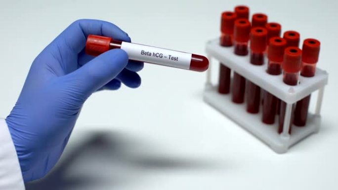 Β-hCG测试，医生在试管中显示血液样本，实验室研究，健康检查