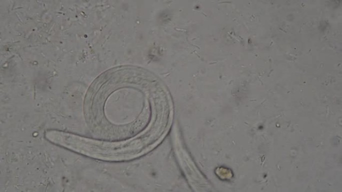 stercoralis圆线虫 (寄生虫) 放大身体，科学概念