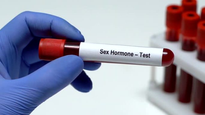 性激素测试，医生在试管中保存血液样本特写，健康检查