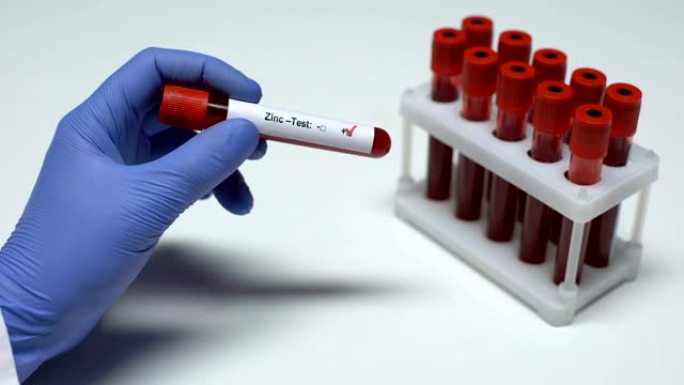 锌测试阳性，医生显示血样，实验室研究，健康检查