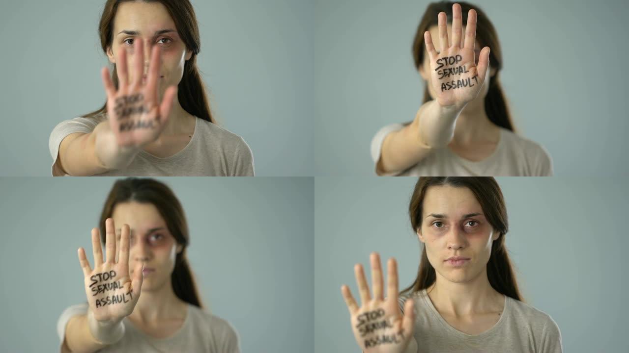 停止在受伤女性的手掌上发性侵犯信息，问题意识预防