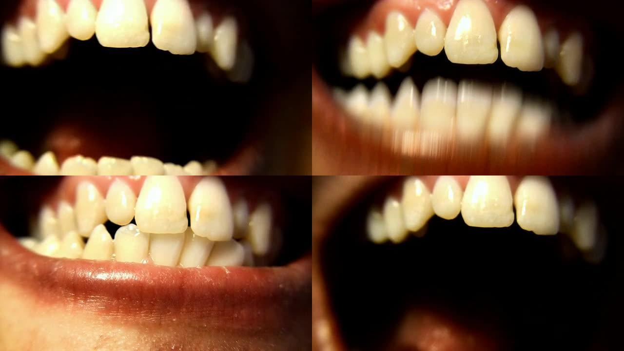 牙齿 (HD)牙齿歪嘴
