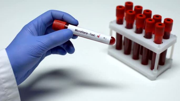 微丝虫试验阴性，医生在试管中显示血样，健康检查