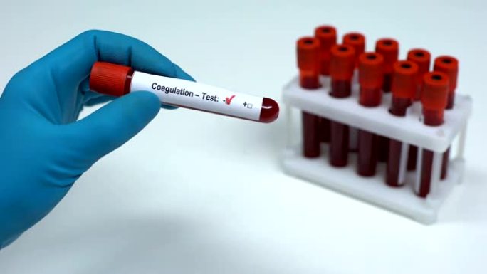 凝血试验阴性，医生显示血样，实验室研究，医疗保健