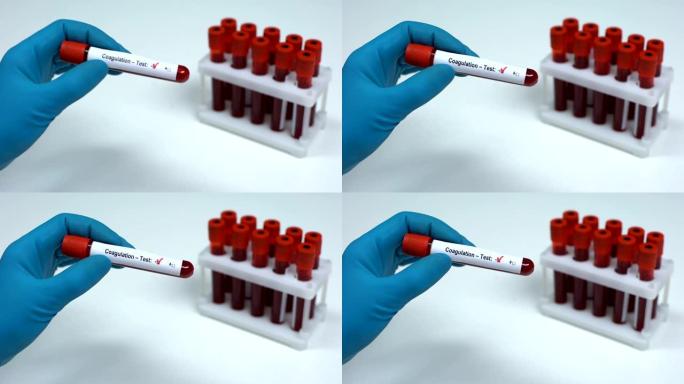 凝血试验阴性，医生显示血样，实验室研究，医疗保健