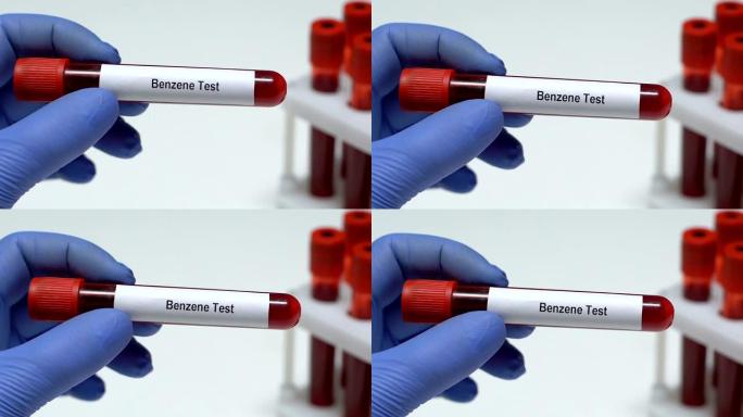 苯测试，医生在试管中保存血液样本特写，健康检查