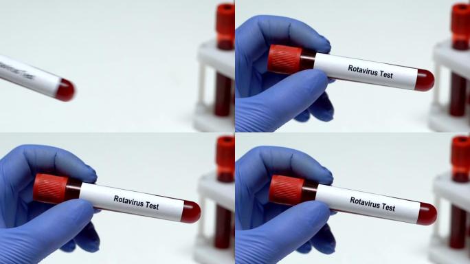 轮状病毒检测，医生在试管中保存血液样本特写，健康检查