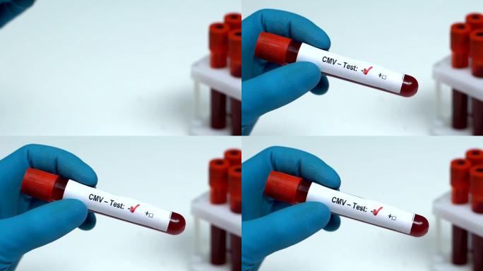 CMV-测试，医生在试管中保存血液样本特写，健康检查