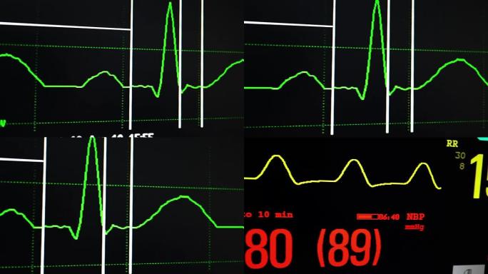 心电图心电图心率心脏死亡生命体征监测仪
