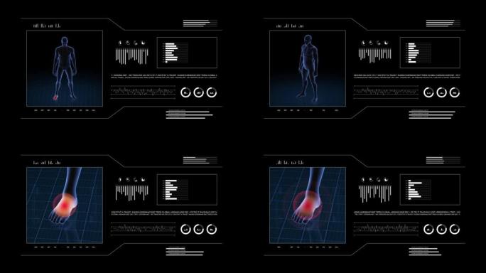 有病理学的人。男孩的3d身体。男性人形。