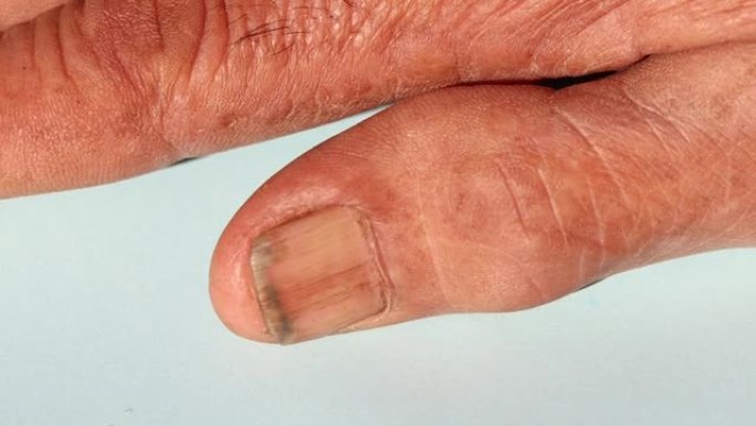 手指和手有皱纹的皮肤