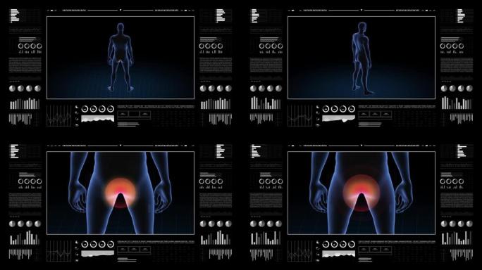 肛门病变的人。男孩的3d身体。男性人体结构的旋转动画和特写。