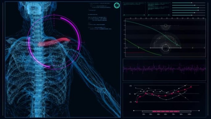 HUD与人体模型的接口。扫描虚拟患者肩伤。